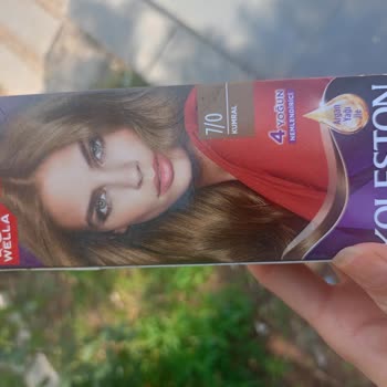 Saç Boyası Sonrası Şiddetli Yanma Ve Aşırı Saç Dökülmesi Yaşadım