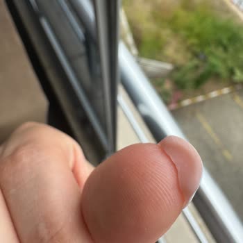 Protez Tırnak Sonrası Sağlık Sorunu Ve Kuaförün Tehditkâr Davranışı