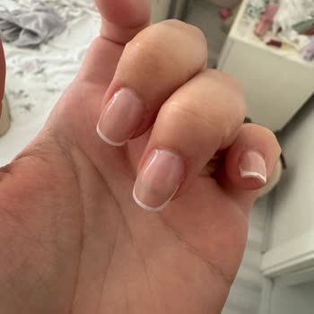 Protez Tırnak Sonrası Sağlık Sorunu Ve Kuaförün Tehditkâr Davranışı