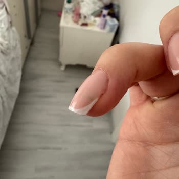 Protez Tırnak Sonrası Sağlık Sorunu Ve Kuaförün Tehditkâr Davranışı