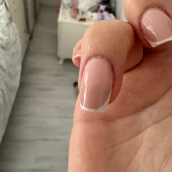 Protez Tırnak Sonrası Sağlık Sorunu Ve Kuaförün Tehditkâr Davranışı