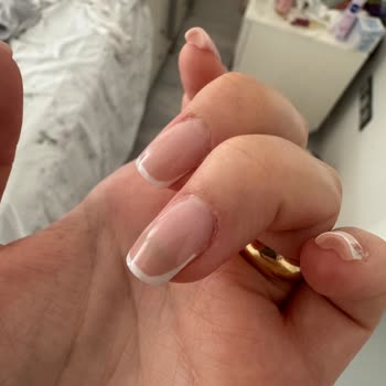 Protez Tırnak Sonrası Sağlık Sorunu Ve Kuaförün Tehditkâr Davranışı