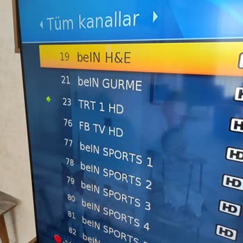 Abonelik Açıldıktan Sonra Kanallar Eksik, Teknik Servis İçin Ücret Talep Ediliyor