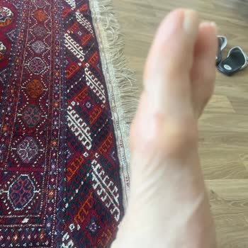 Aldığım Terlik Ayağımı Yaraladı, Çözüm İçin Yaz Sonunu Beklemem İsteniyor!