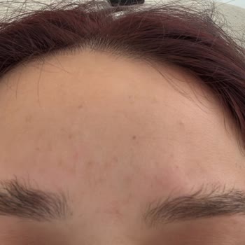 Yapılan İşlemlerden Memnun Kalmadım, Sorunlar Giderilmedi