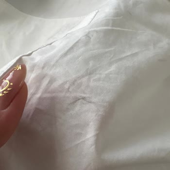 Boyner Uygulamasından Aldığım Gömlek Geç Ve Lekeli Geldi, Destek Yetersiz