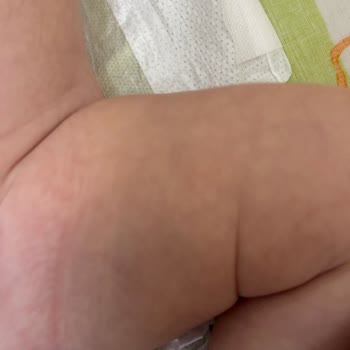 Ebebek Zıbınlarda Boya Sorunu Bebeğimin Sağlığı Tehlikeye Girdi