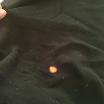 Atlas Beach Helal Alanya Otelde Sağlık Ve Hijyen Sorunları Yaşadık