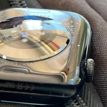 Apple Watch Kasasında Boya Atması Ve Servis Desteği Alamama Sorunu