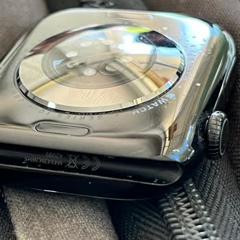 Apple Watch Kasasında Boya Atması Ve Servis Desteği Alamama Sorunu