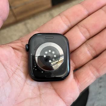 Apple Watch Kasasında Boya Atması Ve Servis Desteği Alamama Sorunu