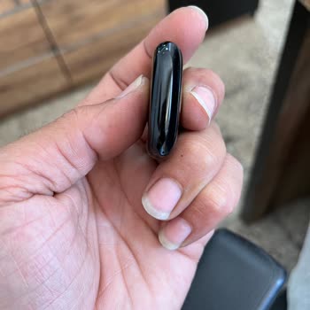 Apple Watch Kasasında Boya Atması Ve Servis Desteği Alamama Sorunu