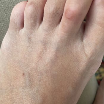 İlk Kullanımda Ciddi Yara Yapan Terliğin İadesini İstiyorum