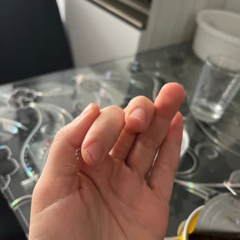 Hazır Aşurede Kıl Çıkması Hijyen Ve Güven Sorunu Yaşattı