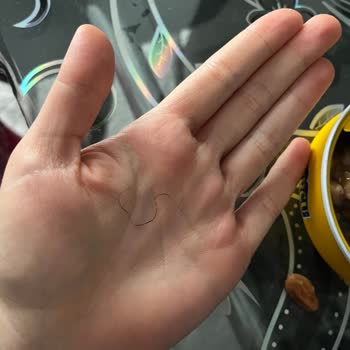 Hazır Aşurede Kıl Çıkması Hijyen Ve Güven Sorunu Yaşattı