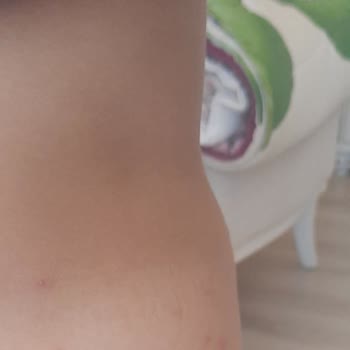 Sağlık Raporuna Rağmen İptal Talebim Reddedildi, Mağduriyetim Giderilmiyor