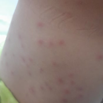 Sağlık Raporuna Rağmen İptal Talebim Reddedildi, Mağduriyetim Giderilmiyor