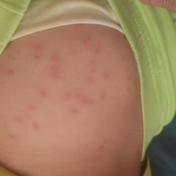 Sağlık Raporuna Rağmen İptal Talebim Reddedildi, Mağduriyetim Giderilmiyor