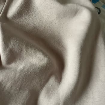 Adidas S***** M******** Eşofman Altında Yoğun Tüylenme Ve Müşteri Hizmetlerinde Hayal Kırıklığı