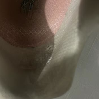 Skechers Ayakkabıda Kısa Sürede Deformasyon Ve Kullanıcı Hatası İddiası Mağduriyeti