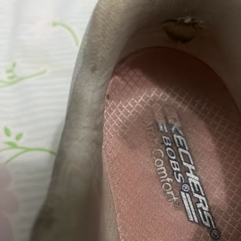 Skechers Ayakkabıda Kısa Sürede Deformasyon Ve Kullanıcı Hatası İddiası Mağduriyeti