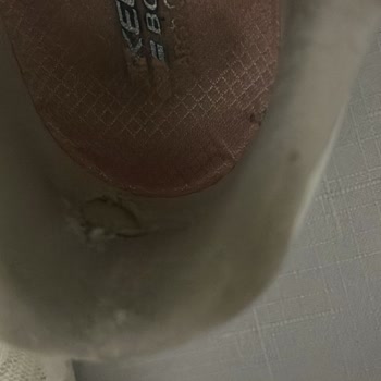 Skechers Ayakkabıda Kısa Sürede Deformasyon Ve Kullanıcı Hatası İddiası Mağduriyeti