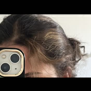 İstenmeyen Saç Rengi Ve Ücret İadesi Talebiyle Mağduriyet Yaşadım