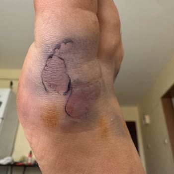 Greyder Sandalet İlk Kullanımda Ciddi Sorunlar Yaşattı