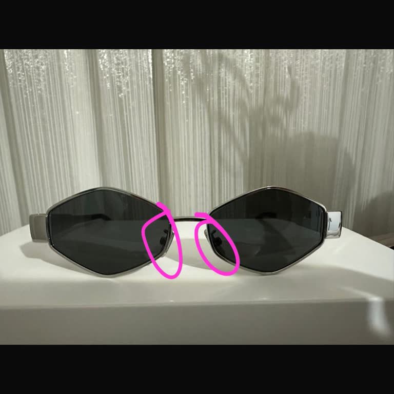 Satın Aldığım Gözlük Kusurlu Çıktı, Mağaza Destek Olmadı