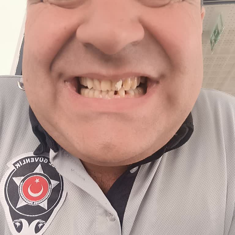 Diş Tedavimde İlgisizlik Ve Sorumsuzlukla Karşılaştım