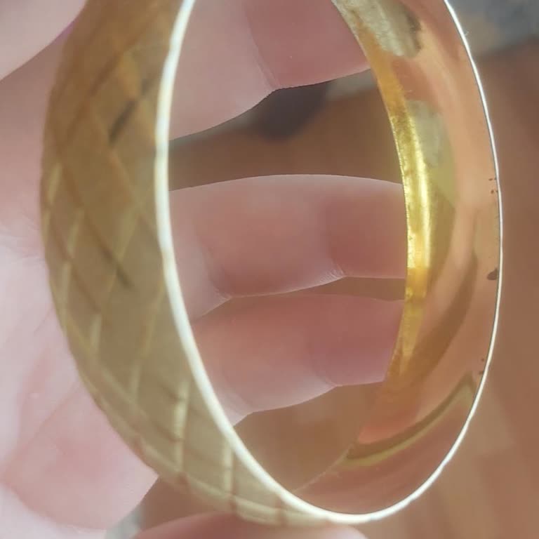 Ferizz Sitesinden Gelen Deforme Bilezik Ve İlgisiz Hizmet Mağduriyeti