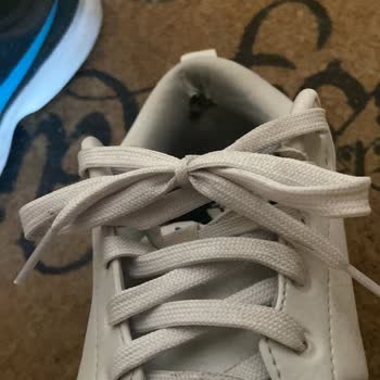 Kısa Sürede Deforme Olan Adidas Ayakkabı Ve Garanti Sürecinde Yaşanan Sorunlar