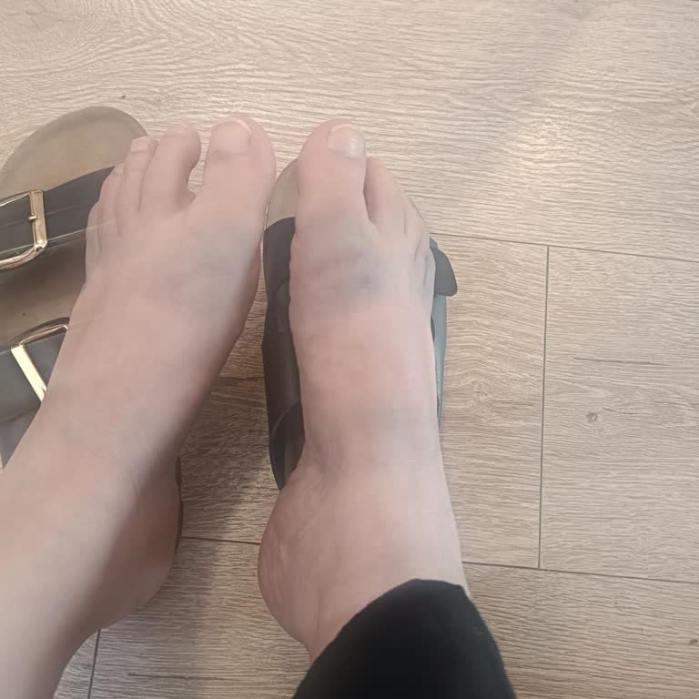 Polaris Terlik Ayaklarımı Boyadı, İade Talebim Reddedildi