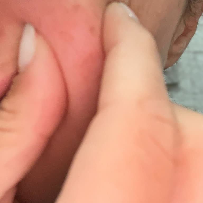 Estetik İşlem Sonrası Yüzümde Kalıcı Hasar Ve İlgisizlik