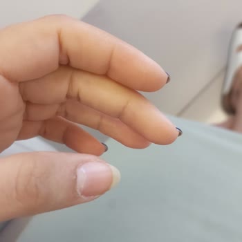 Tuğçe Çetin Beauty Kalıcı Oje 2. Günde Çıktı