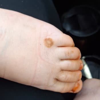 Bebeğime Aldığım Ayakkabı Paslandı, Mağaza Çözüm Sunmadı!