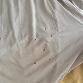 Yeni Alınan Çamaşır Makinesi Eşyalarımı Yırttı, Mağdur Oldum