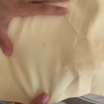 Açık Gelen Kargo, Lekeli Elbise Ve Çözümsüz İade Süreciyle Mağduriyet Yaşadım