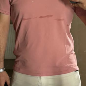 Bosch Serie4 Çamaşır Makinesi Yıkama Ve Çekme Sorunları, Servis İlgisizliği