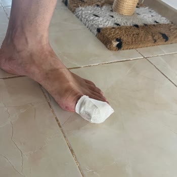 Yeni Aldığım Scooter Arızalandı Media Markt İlgisiz Kaldı