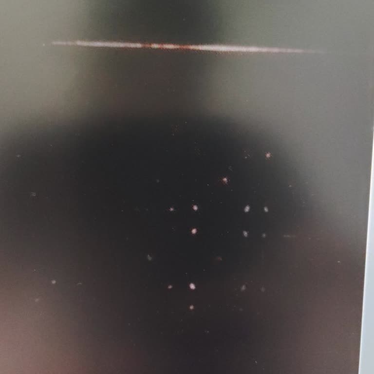 Yeni Alınan Laptopta Ekran Sorunu Ve Yüksek Onarım Ücreti Şoku