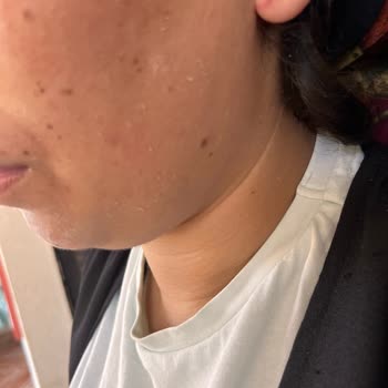 Bozuk Güneş Kremi İçin İade Ve Mağduriyetimin Giderilmesini Talep Ediyorum