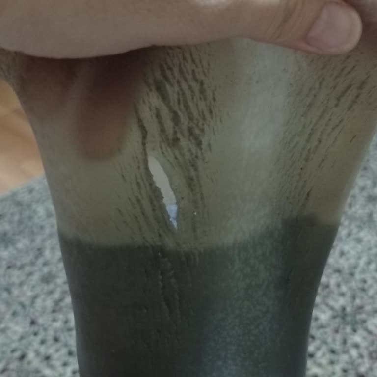 Ottobock Silikon Liner Sürekli Çatlıyor Ve Yırtılıyor