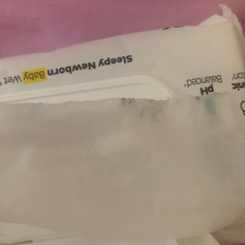 Sleepy Islak Mendillerde Tarihi Geçmiş Ve Küflü Ürün Sorunu