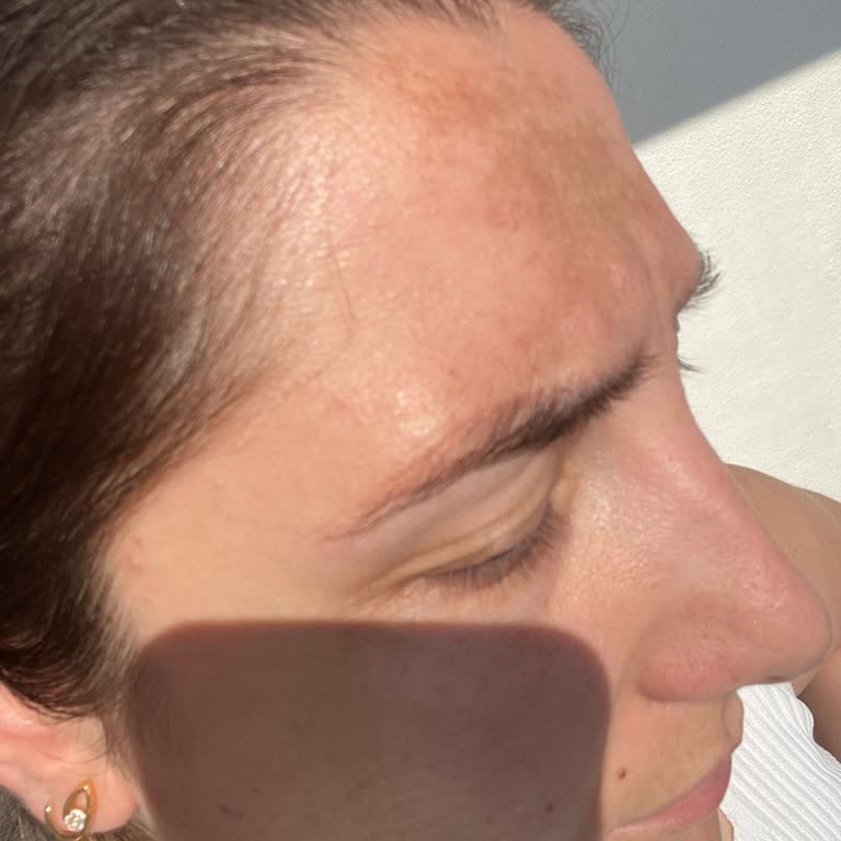 Kaş Uygulamam Kızıllaştı Ve Çözüm Sunulmuyor