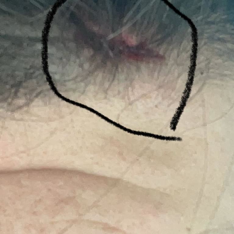 Starbucks Sivas AVM Şubesinde Yaşadığım Ciddi Kaza Ve İlgisizlik