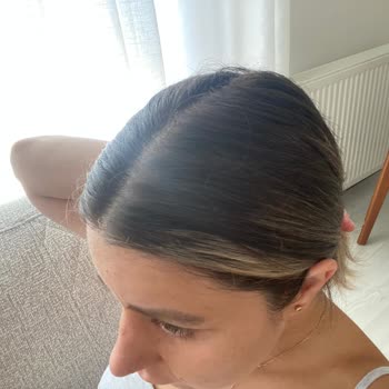 Saç Rengimdeki Dengesizlik Hayal Kırıklığı Yarattı