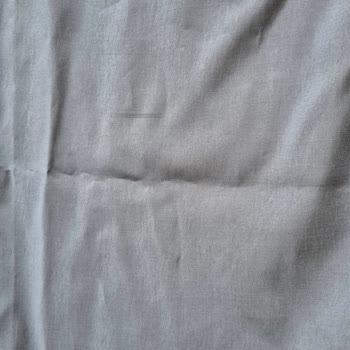 Defolu Gelen Üründe Haksız İade Kesintisi Ve Müşteri Hizmetlerine Ulaşamama