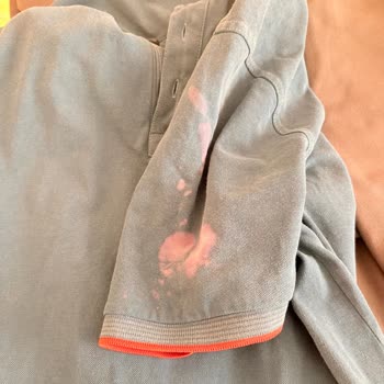 OMO Sıvı Deterjan Kıyafetlerimi Geri Dönülmez Şekilde Zarar Verdi