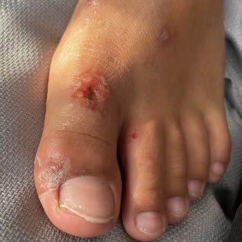 Otel Tatilinde Sağlık Sorunları Ve İlgisizlik Mağduriyeti